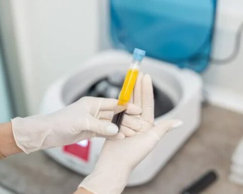 Platelet-rich plasma treatments for IVF patients