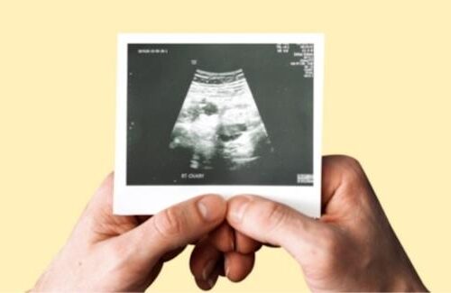 HRC Fertility's Dr. John Norian - Men's Guide to Infertility