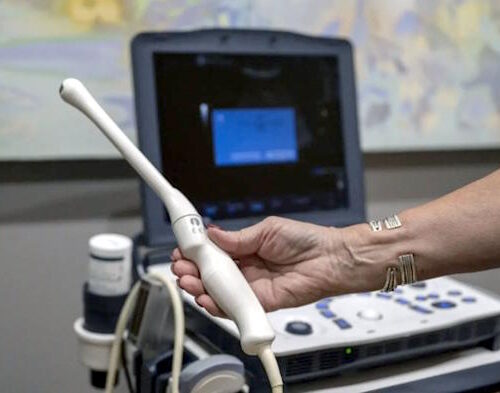 Dr. Becht of HRC Fertility reveals study about fertility anxiety at age 23.